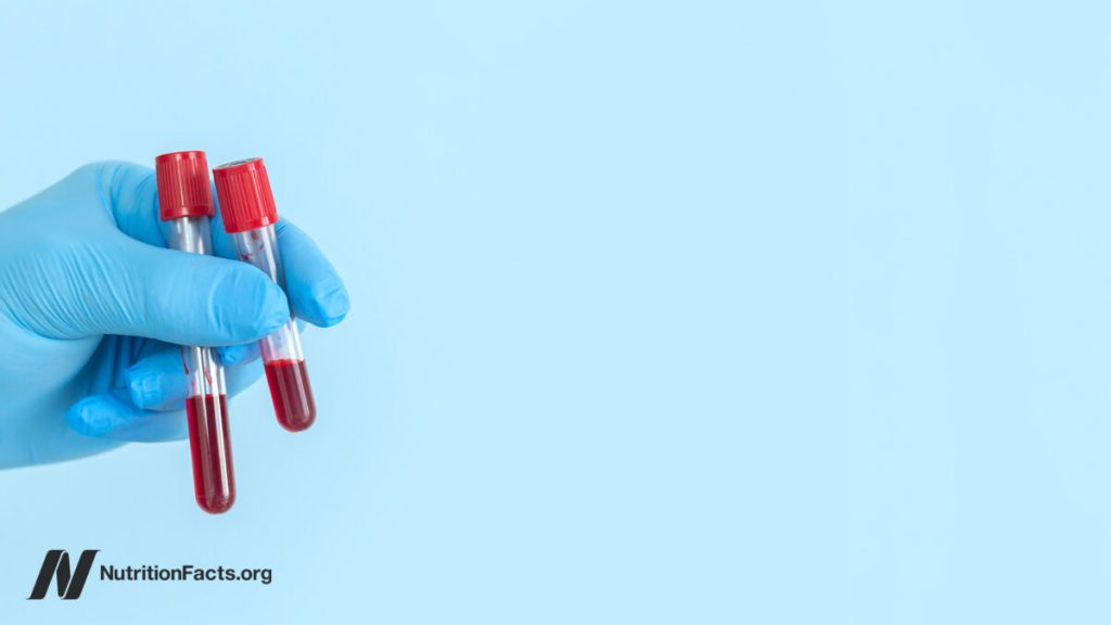 How to Treat High Lp(a), an Atherosclerosis Risk Factor 