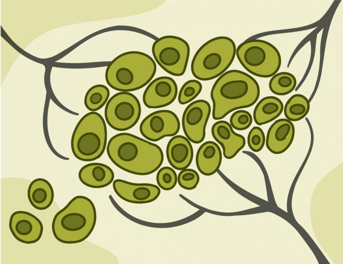 Illustration of cells migrating out of a tumor.