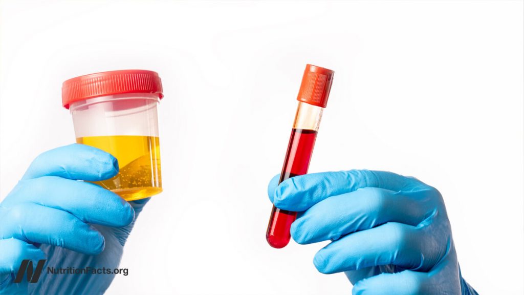 Testing for Vitamin B12 Deficiency Testing for Vitamin B12 Deficiency