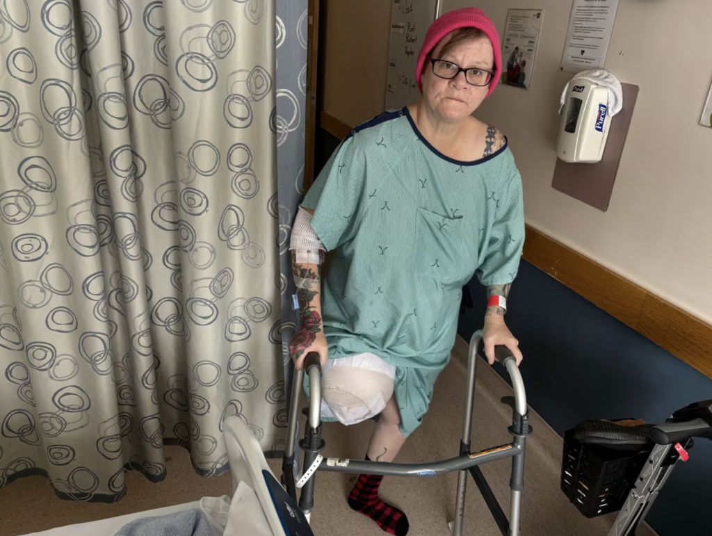 Woman Who Spent Days in Hospital with Painful Open Wound Waiting to Be Stitched Up Ends Up Losing Entire Leg