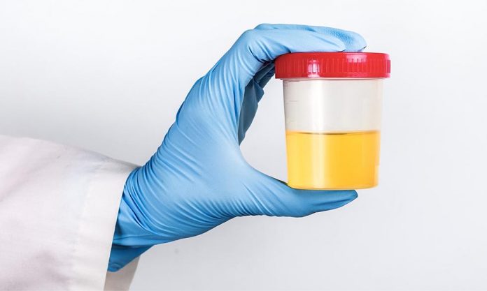 What makes urine yellow? The answer lies in your gut