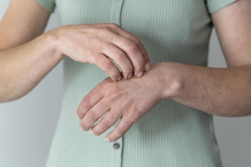 You Shouldn’t Scratch An Itch—So Why Does It Feel So Good? Are There Benefits?
