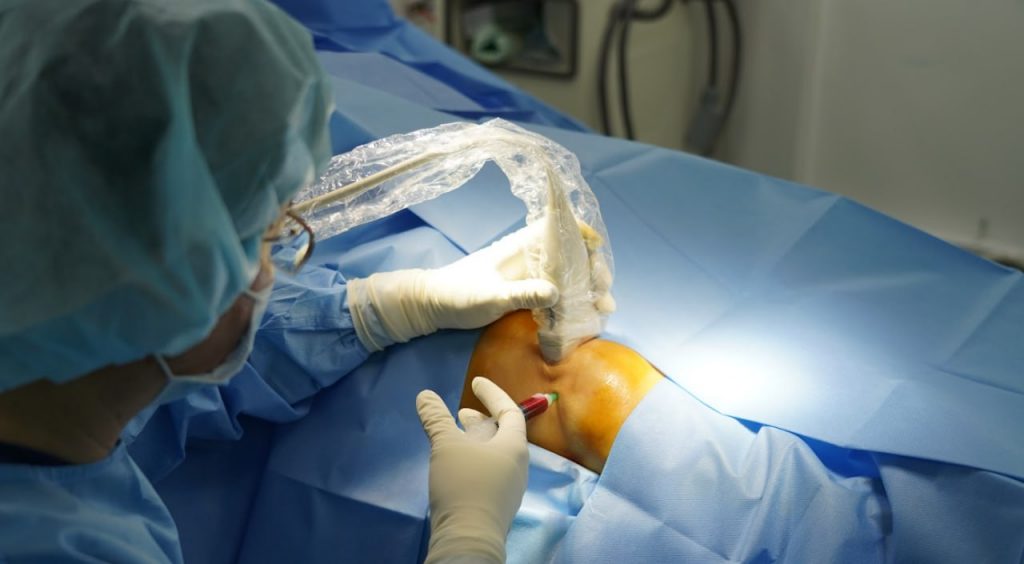 Knee Stem Cell Injection Gains Attention as an Innovative Treatment Knee Stem Cell Injection Gains Attention as an Innovative Treatment
