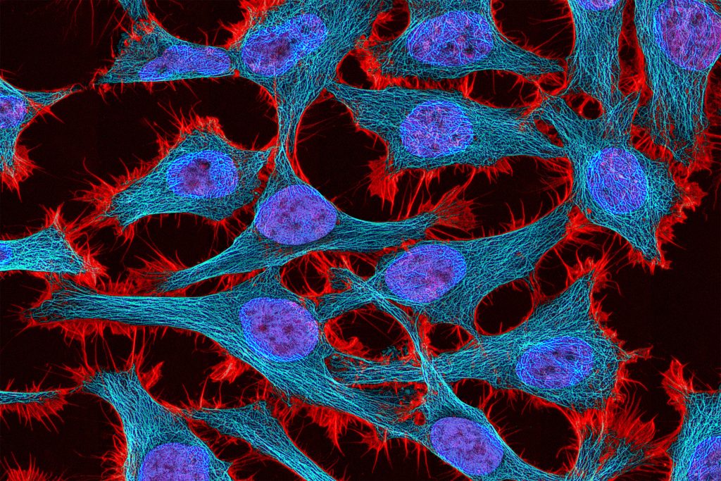 Gene circuits enable more precise control of gene therapy | MIT News Gene circuits enable more precise control of gene therapy | MIT News