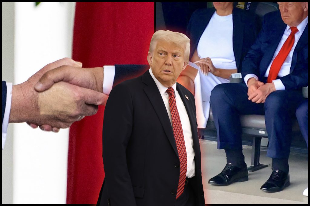 White House Finally Addresses Trump’s Mysterious Bruising and Swollen Ankles