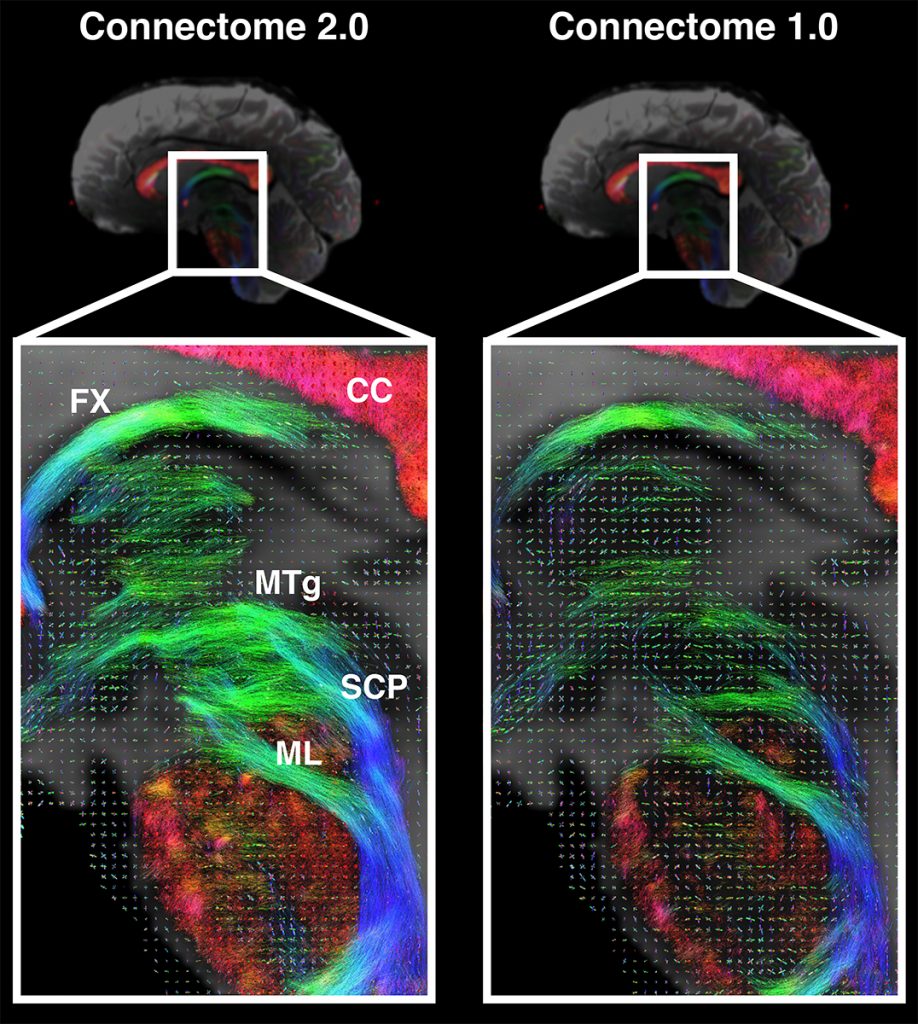 Scientists Develop High-Performance MRI Scanner in Effort to Define Microscopic Brain Structures Scientists Develop High-Performance MRI Scanner in Effort to Define Microscopic Brain Structures