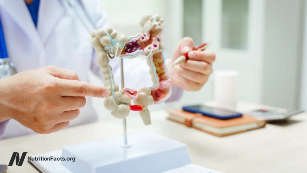 The Validity of SIBO Tests The Validity of SIBO Tests