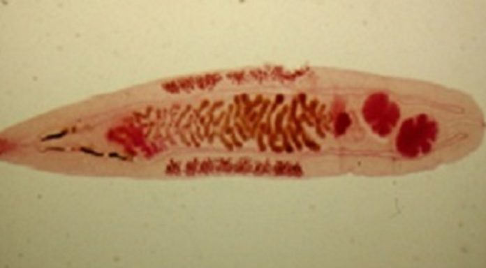 About Liver Flukes | Liver Flukes