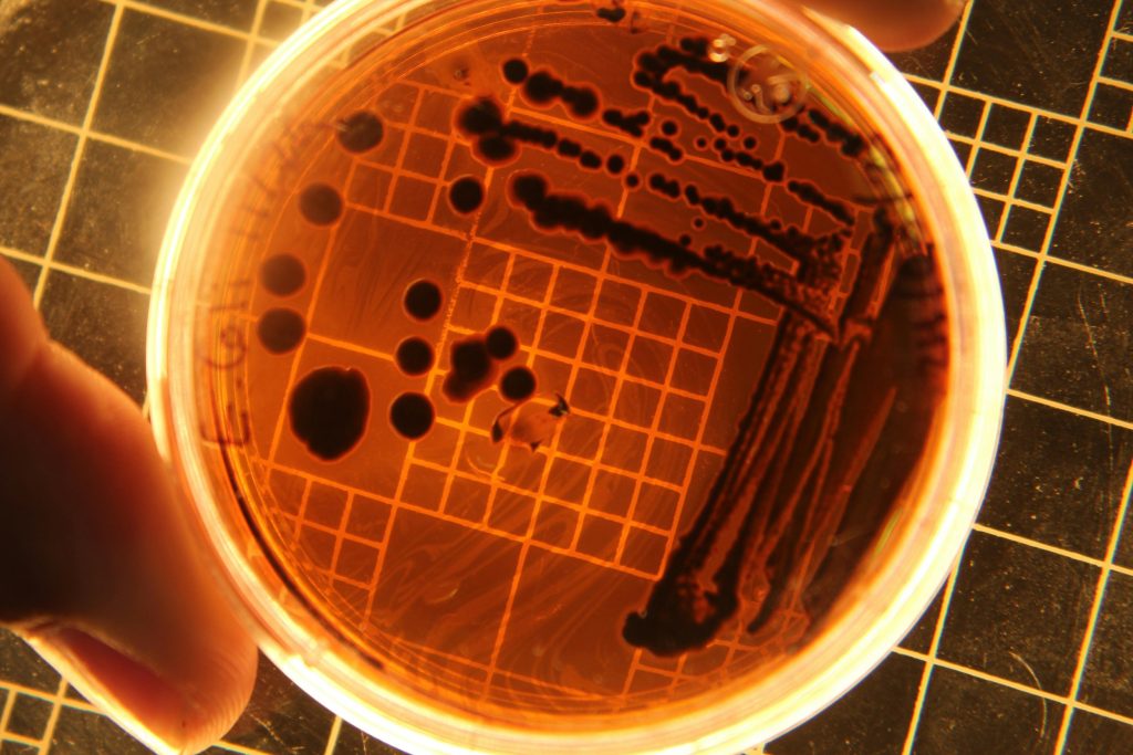 Salmonella Outbreak Sickens 16, CDC Warns of More Cases Salmonella Outbreak Sickens 16, CDC Warns of More Cases
