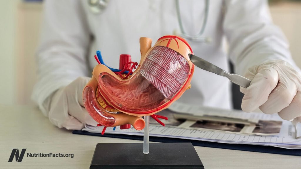 The Hidden Costs of Bariatric Surgery The Hidden Costs of Bariatric Surgery