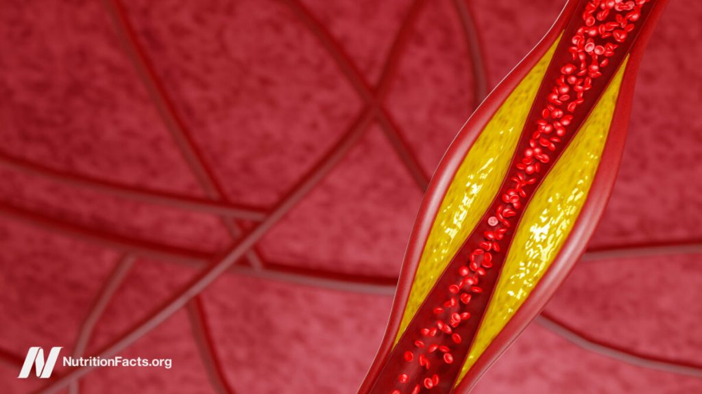 How Low Can LDL Cholesterol Go on PCSK9 Inhibitors?