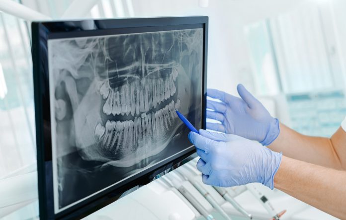 Are Dental X-Rays safe? | American Association of Orthodontists