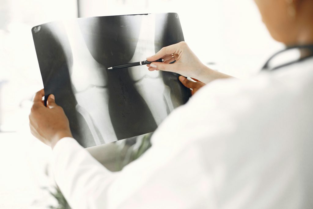 Why This Silent Bone Disease Is Often Missed