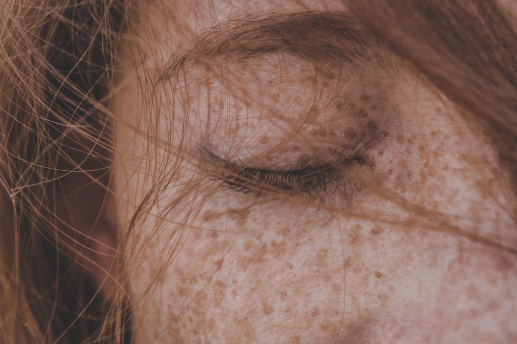 When an Autoimmune Skin Condition Signals Systemic Inflammation