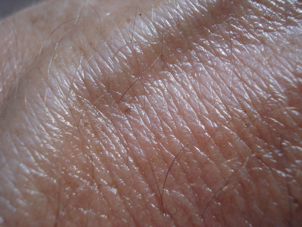 Melanoma ABCDEs, Non‑Melanoma Skin Cancers, and When to See a Dermatologist