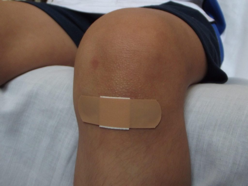 Clotting Scabs and Regeneration Explained Through the Wound Healing Stages