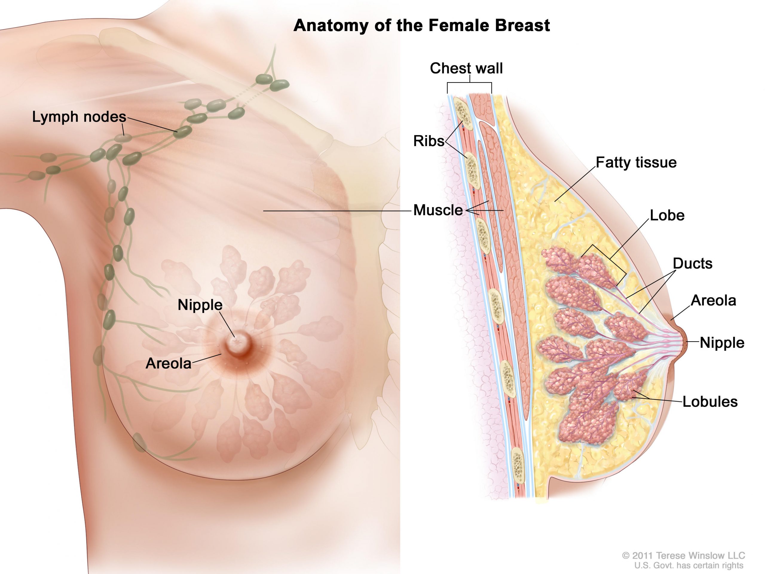 What Is Breast Cancer? – NCI What Is Breast Cancer? – NCI
