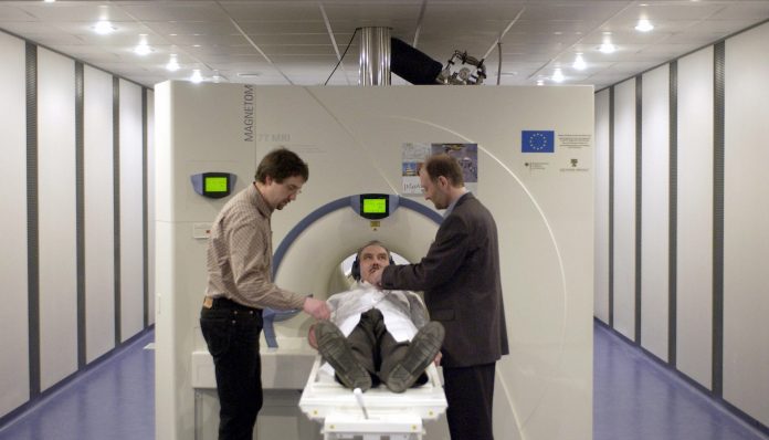 Mini-Stroke Linked to 34% Higher Dementia Risk, with One in Five Ontario Patients Diagnosed Over About Seven Years